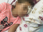 Тамбовские офтальмологи считают, что вернуть зрение пострадавшей в липецком лагере девочке практически невозможно
