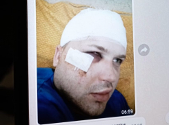 Тамбовского собаколова избили в Липецке