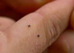 За прошедшие тёплые месяцы клещи укусили почти 1 700 тамбовчан