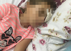Тамбовские офтальмологи считают, что вернуть зрение пострадавшей в липецком лагере девочке практически невозможно
