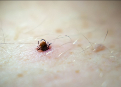 Как защититься от клещей?